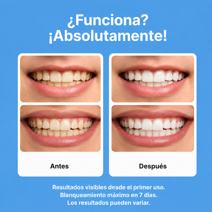 Toomik™ - Tiras Blanqueadoras de coco